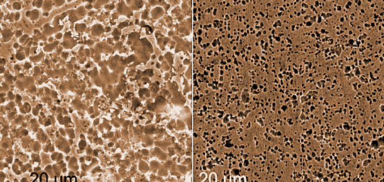 Сплав для вечного импланта